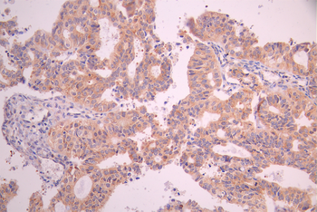 HOMER1 Antibody