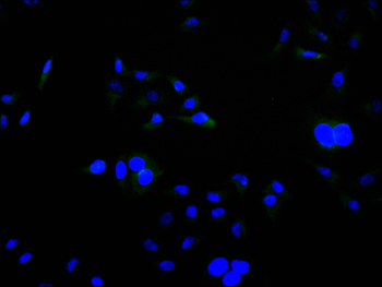 HOMER1 Antibody