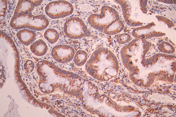 EMC4 Antibody