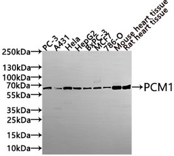 PGM1 Antibody