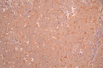 PGM1 Antibody