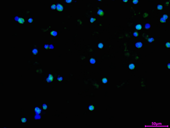 PGM1 Antibody