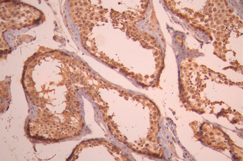 PCBP2 Antibody