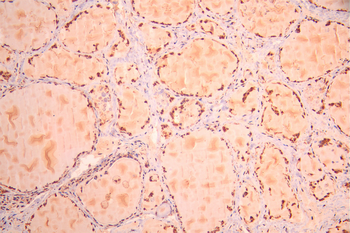 PRPF31 Antibody