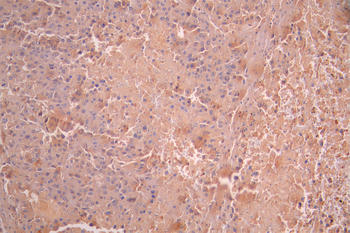 AAMP Antibody