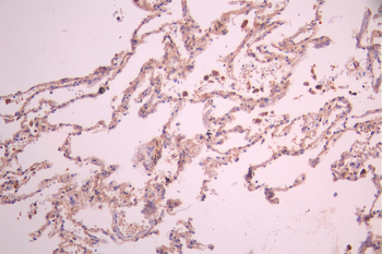 ATG4B Antibody