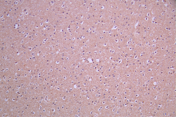 SNAP25 Antibody