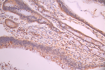 SNAP25 Antibody