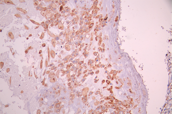 ADSS Antibody