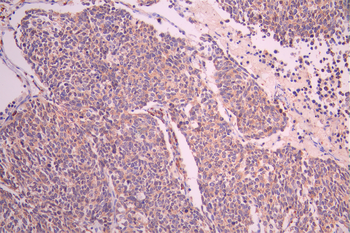 ADSS Antibody
