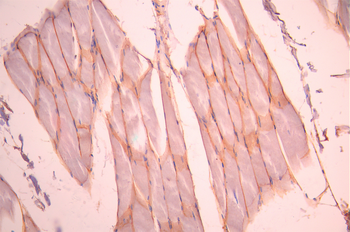 SGCD Antibody