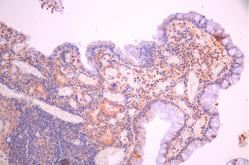 SGCD Antibody