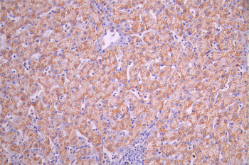 ACAT1 Antibody