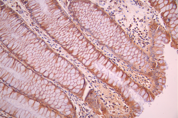 ACAT1 Antibody