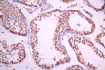 RBMXL2 Antibody
