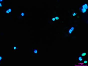 RBMXL2 Antibody