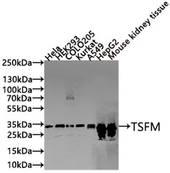 TSFM Antibody