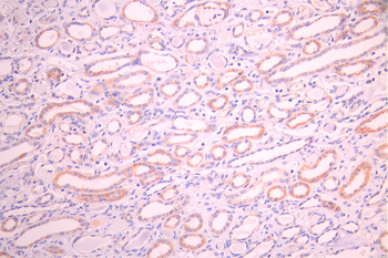 TSFM Antibody
