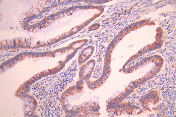 TSFM Antibody
