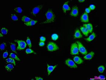 TSFM Antibody