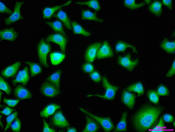 CHD4 Antibody