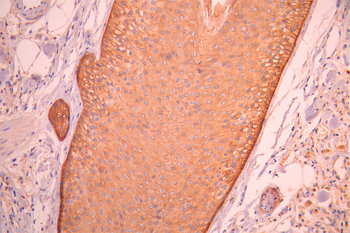 IVL Antibody