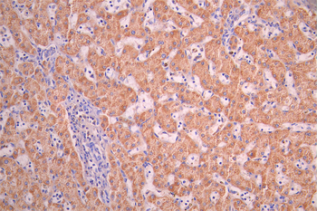 ACADS Antibody