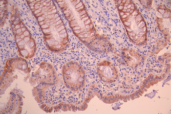 ACADS Antibody