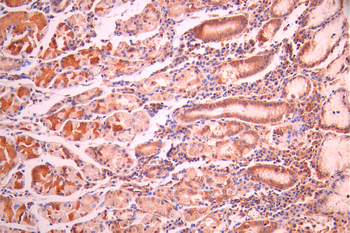 CYFIP1 Antibody