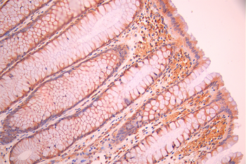 CYFIP1 Antibody
