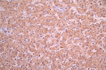 NAT1 Antibody