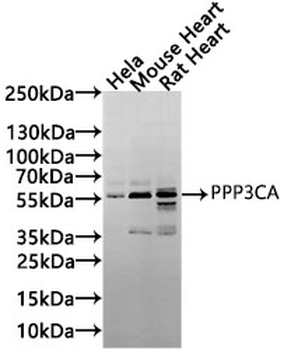 PPP3CA Antibody