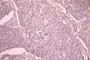 PDIA3 Antibody
