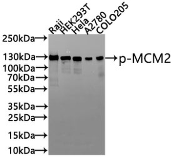 MCM2 Antibody