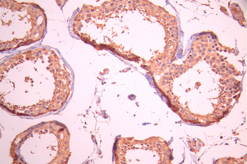 PLIN2 Antibody