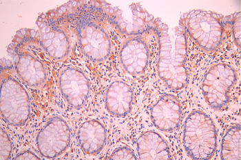 PLIN2 Antibody