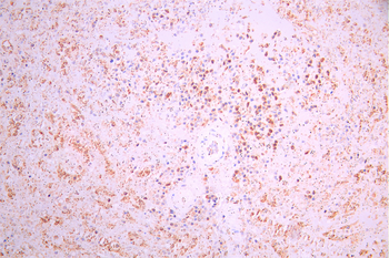 BLNK Antibody