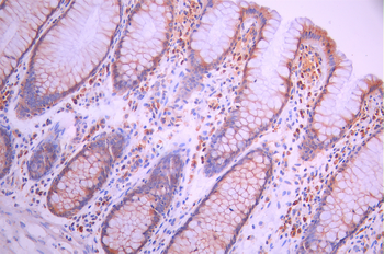 BLNK Antibody