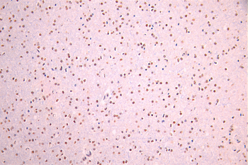ZHX2 Antibody