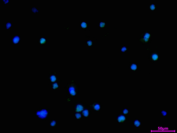 ZHX2 Antibody