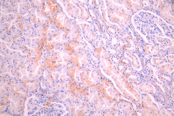 PRDX6 Antibody