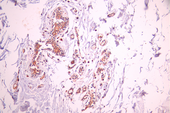 PRDX6 Antibody