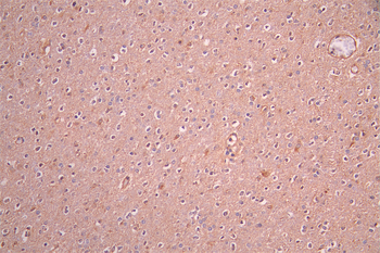 CAMK2A Antibody