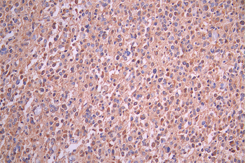 CAMK2A Antibody