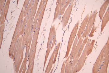 GFPT1 Antibody