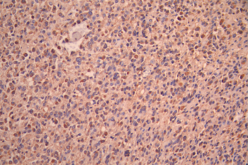GFPT1 Antibody