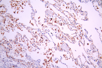 Icam2 Antibody