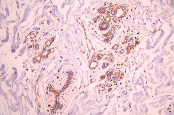 Icam2 Antibody