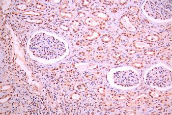 RPS6KA3 Antibody