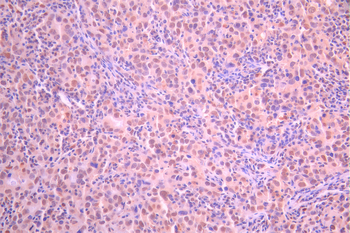 RPS6KA3 Antibody